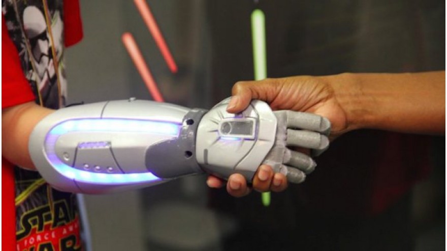 Open Bionics Inspired Bionic Hands